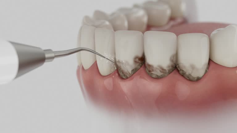 Trusted Teeth Cleaning And Checkup service in Iowa City, IA - Dentist Open Now